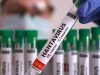 Cegah Penyebaran Hantavirus, Kemenkes Imbau Masyarakat Jaga Kebersihan Lingkungan